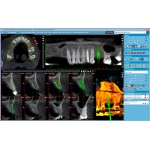 Promax 3D Plus Promax 3D Plus